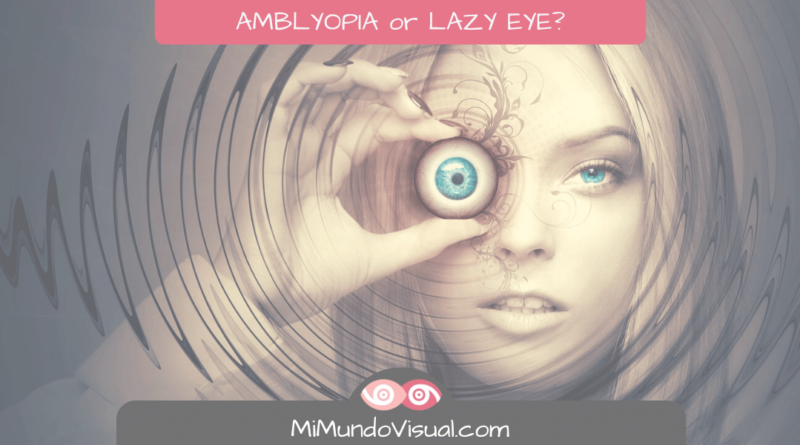 What is amblyopia, or Lazy eye or lazy eye? What are the the symptoms of amblyopia? How do we treat it?