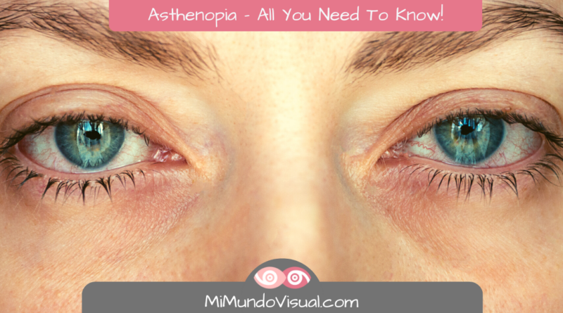 Asthenopia – All You Need To Know! - MiMundoVisual.com