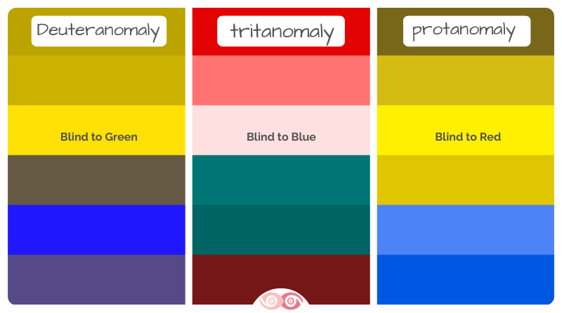 Types of color blindness - protanomaly - deuteranomaly - tritanomaly.