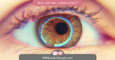6 Preguntes Sobre Què Són Les Cataractes - MiMundoVisual.com