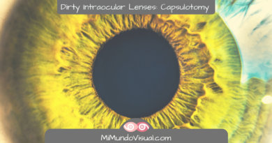 All About Dirty Intraocular Lenses Capsulotomy