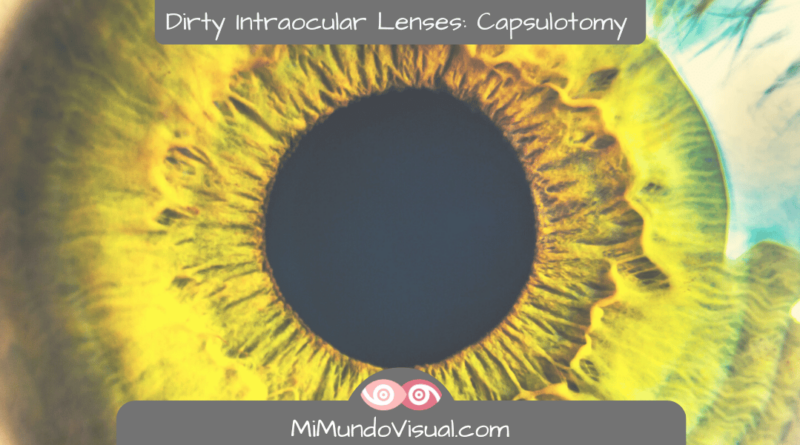 All About Dirty Intraocular Lenses Capsulotomy