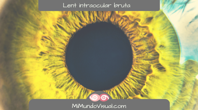 Lent Intraocular Bruta Capsulotomia - MiMundoVisual.com
