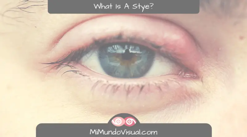 What Is A Stye And Why Do They Appear