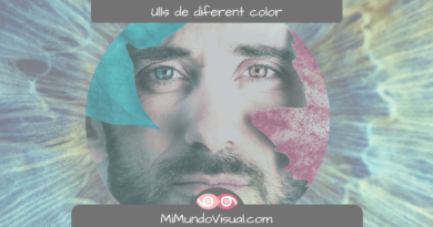 Com Se Li Diu A Les Persones Que Tenen Els Ulls De Diferent Color - MiMundoVisual.com