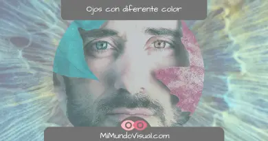 ¿Cómo Se Le Dice A Las Personas Que Tienen Los Ojos De Diferente Color - mimundovisual.com