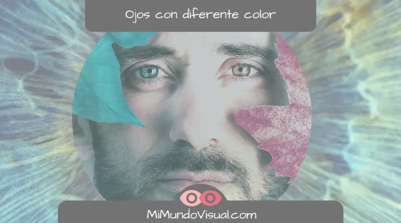 ¿Cómo Se Le Dice A Las Personas Que Tienen Los Ojos De Diferente Color - mimundovisual.com
