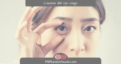 Causas del ojo vago - mimundovisual.com